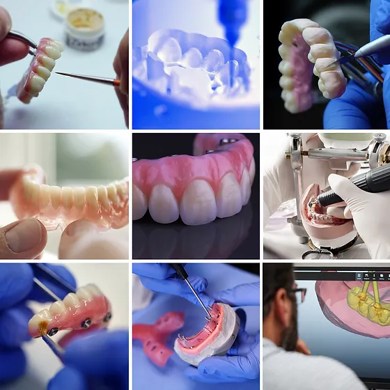 بهترین آزمایشگاه دندانپزشکی در تهران