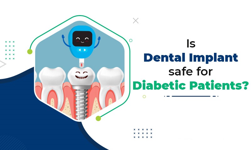 بیماری دیابت در ایمپلنت دندان چه تاثیری دارد