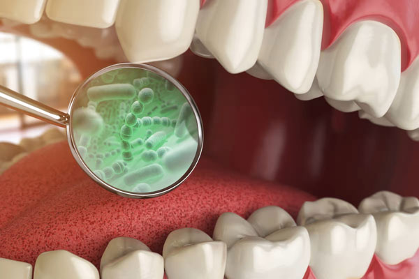 درمان عفونت ایمپلنت دندان چگونه انجام میشود 