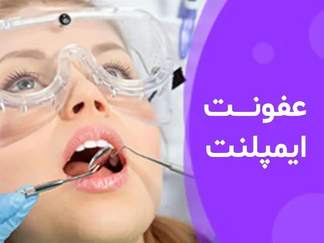 عفونت ایمپلنت دندان و روش های درمان آن
