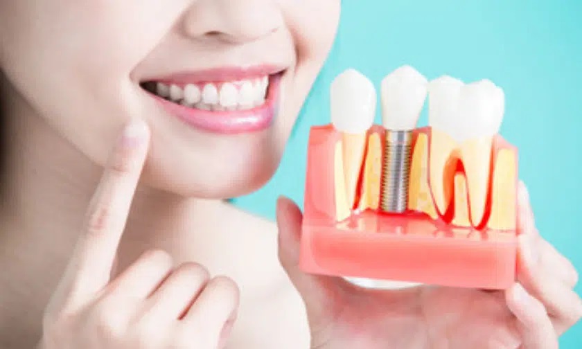 چه علائمی باعث عفونت ایمپلنت دندان میشود