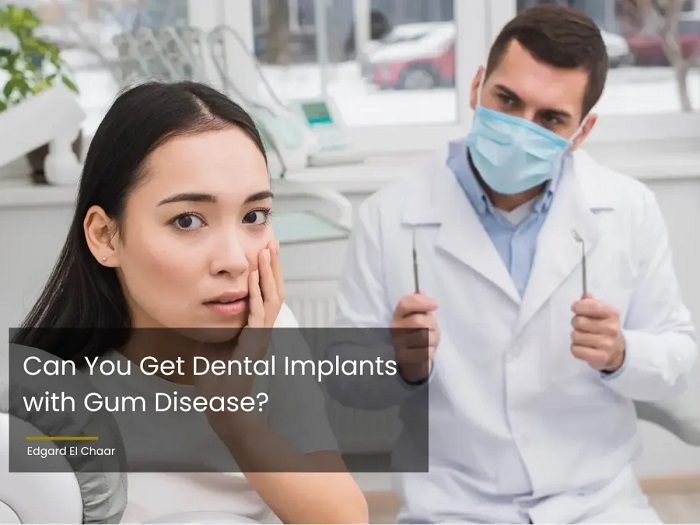 آیا با بیماری لثه می توان ایمپلنت دندان انجام داد؟
