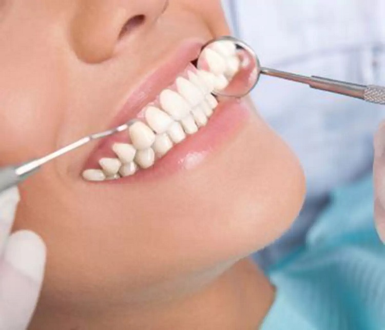 روکش دندان چیست و چه مزایایی دارد