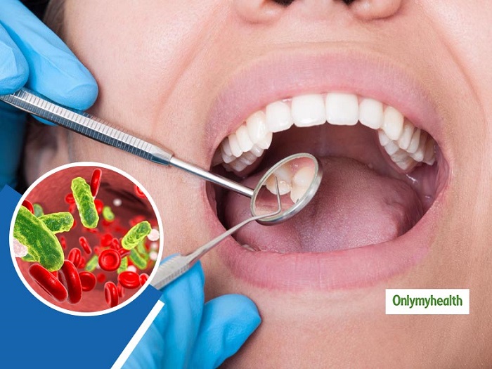 عفونت دندان چه علائمی دارد