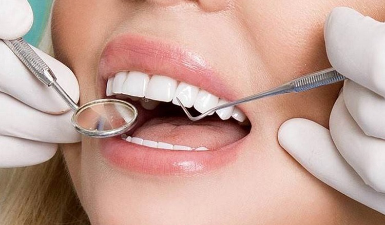 لمینت دندان و چگونه انجام میشود