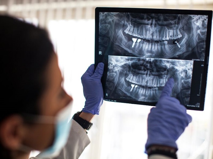 فناوری های تصویربرداری در ایمپلنتولوژی دندان
