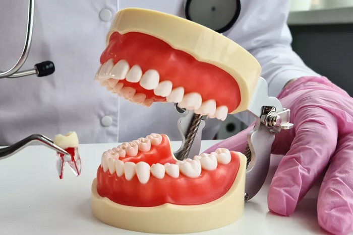 چگونه باید از ایمپلنت دندان خود مراقبت کنم