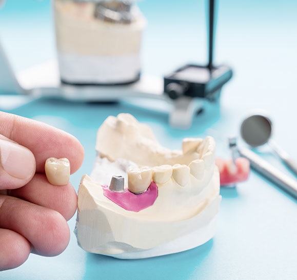 پروتز دندان چه مزایایی دارد