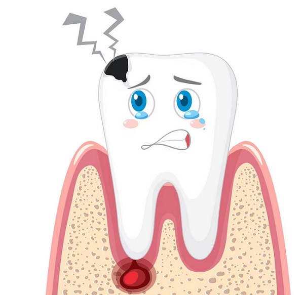 تروما دندان چه علائمی دارد
