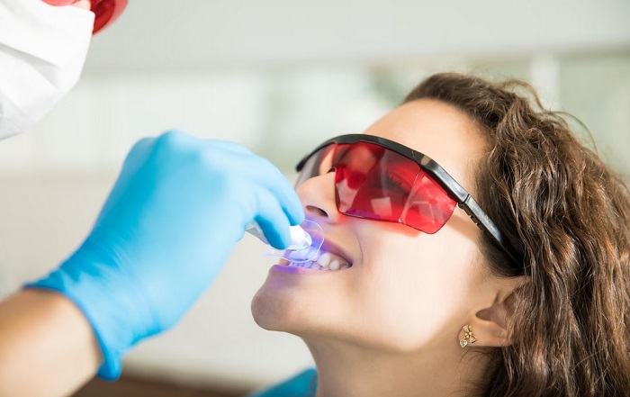 فلوراید تراپی دندان چیست