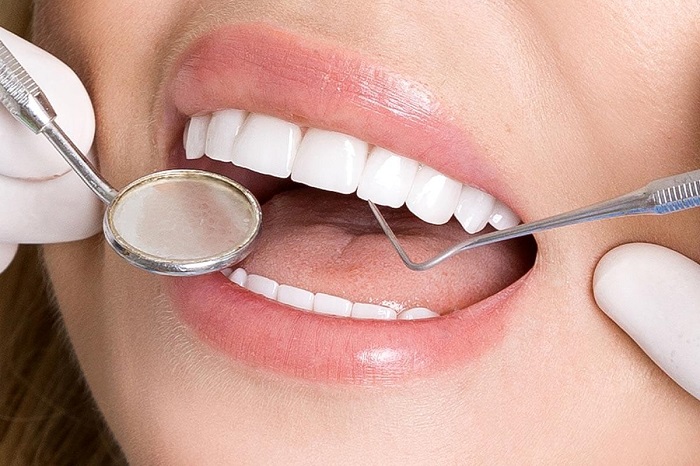 لیمنت دندان چه مزایایی دارد
