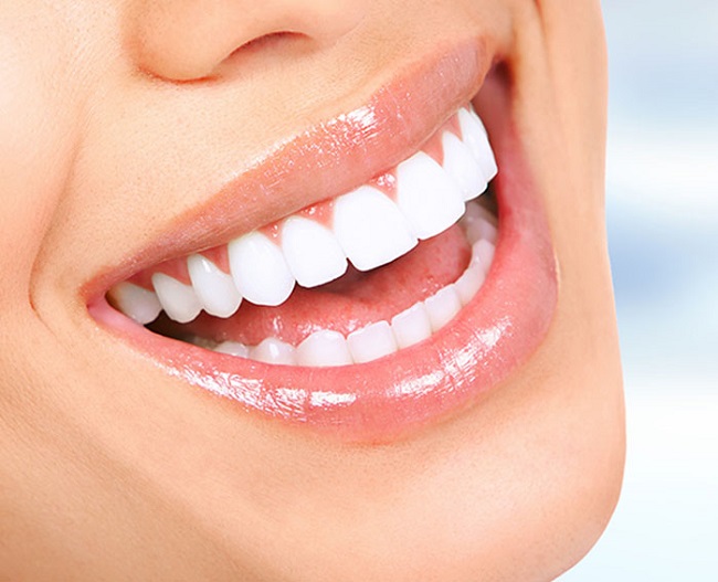 بلیچینگ دندان چه مزایایی دارد