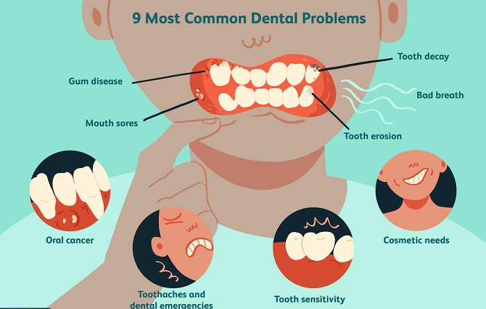 مشکلات رایج دهان و دندان کدامند