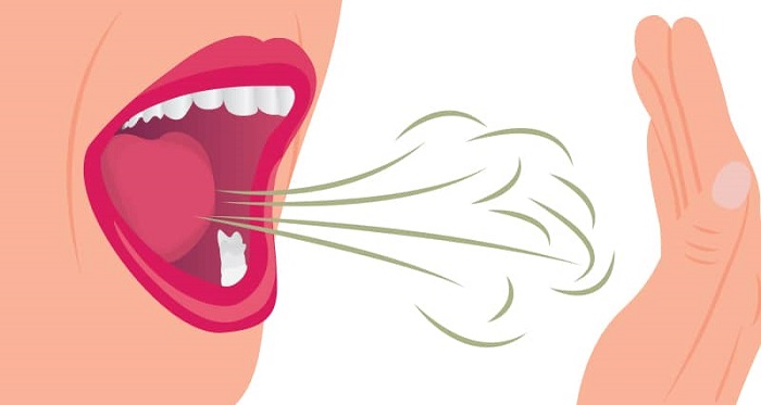 چه چیزی باعث بوی بد دهان می شود؟