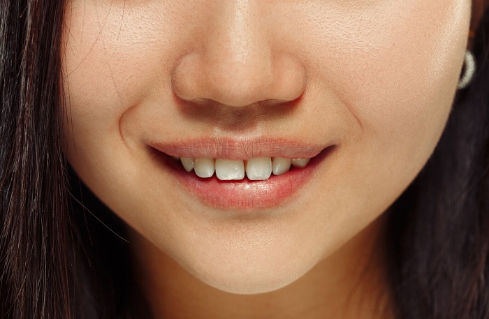 درمان فاصله بین دندان چقدر طول میکشد