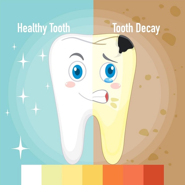 پوسیدگی دندان چگونه درمان میشود