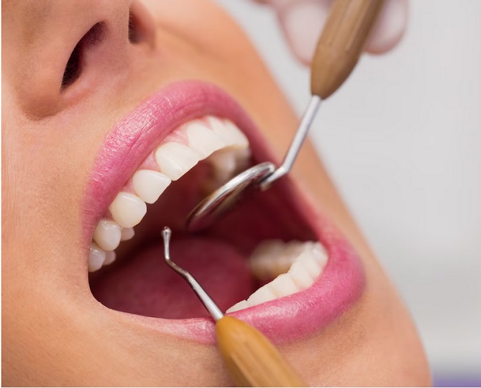 روش های دندانپزشکی زیبایی کدامند