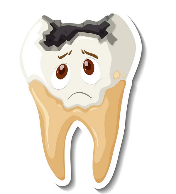 چه چیزی باعث فرسایش دندان می شود؟