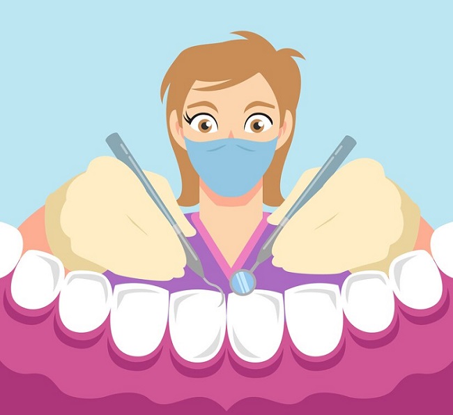 انجام لمینت دندان چه مزایایی دارد