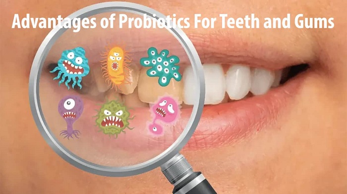 پروبیوتیک دندانی چه مزایایی دارد