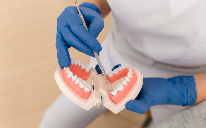 انواع پروتز دندان و مزایای آن