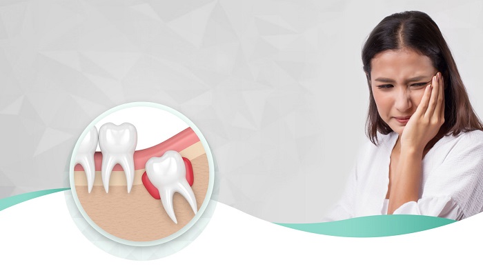 چرا ما دندان عقل داریم و چگونه درمان کنیم