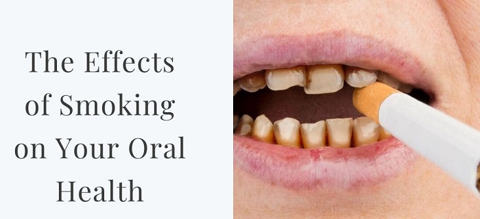 سیگار بر سلامت دهان و دندان چه تاثیری دارد