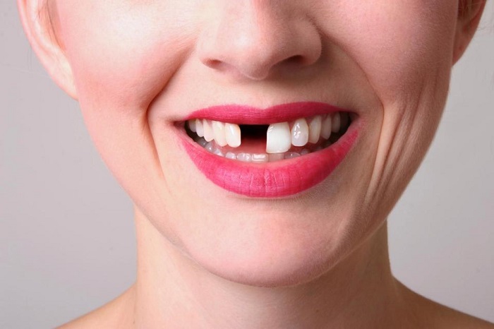 بی دندانی چه عوارضی برای بدن دارد