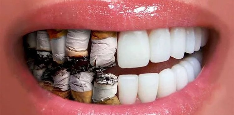 تاثیر سیگار روی دندان ها چگونه است