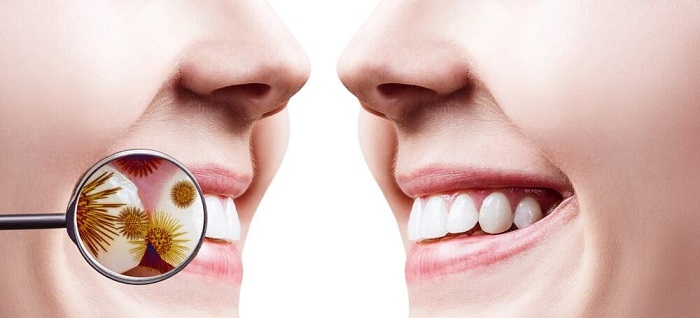 روش های درمان آبسه دندان کدامند