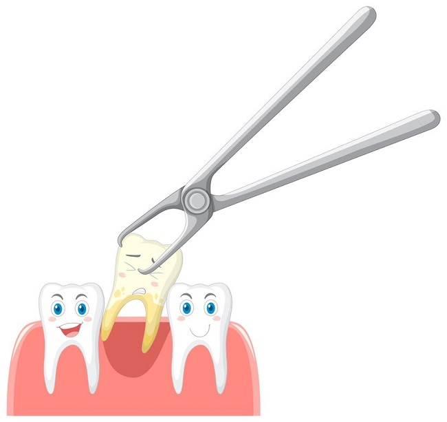 چه درمان هایی برای لق شدن دندان لازم است