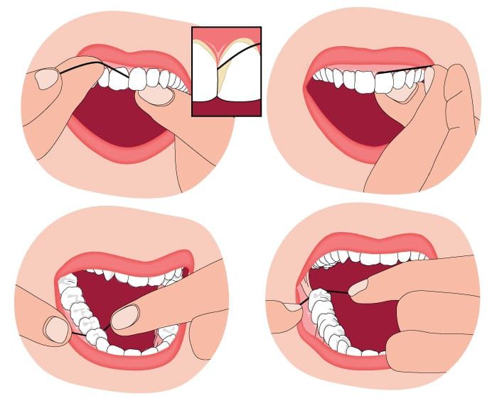 چگونه از نخ دندان استفاده کنیم