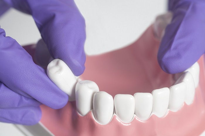 دندان های مولر چندین عملکرد مهم را در دهان انجام می دهند