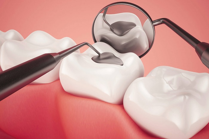 کامپوزیت دندان کدام مشکلات دهان و دندان را پوشش میدهد و چگونه انجام میشود