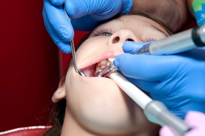 برای درمان پالپوتومی چه زمانی باید به دندانپزشک مراجعه کنیم