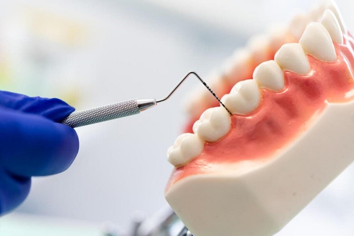 برای درمان کورتاژ لثه چه زمانی به دندانپزشک مراجعه کنیم