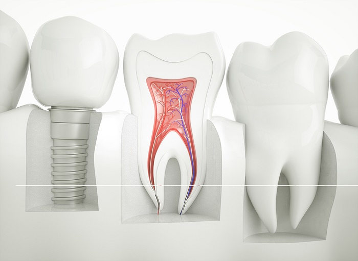 روش های درمان تیر کشیدن دندان کدامند
