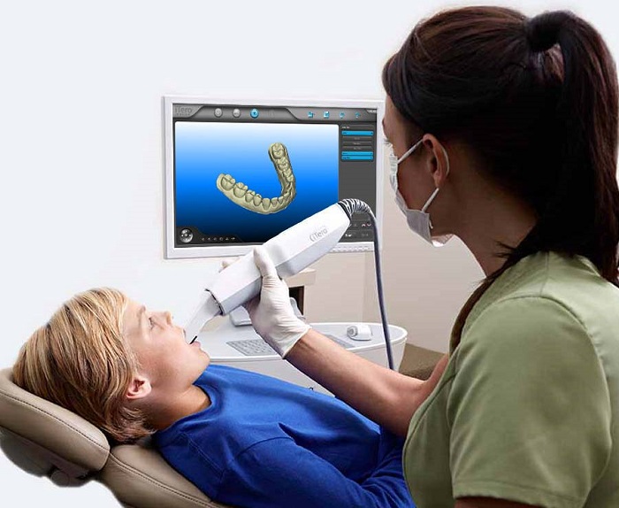 قالب گیری دیجیتال دندان چیست و چه کاربردی دارد