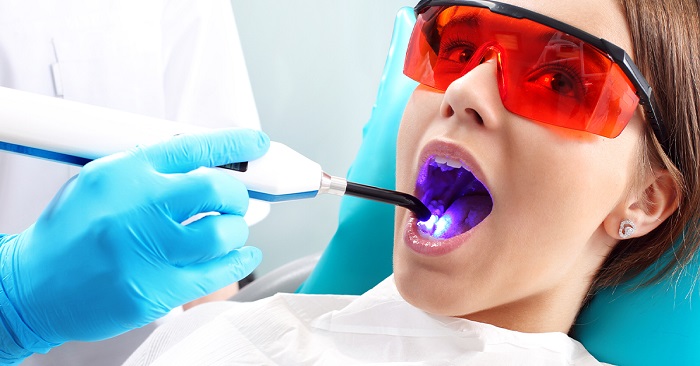 لایت کیور در دندانپزشکی چیست و چه کاربردی دارد