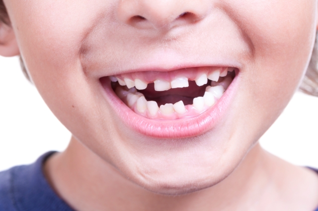 برای درمان ماملون دندان چه زمانی باید به متخصص دندانپزشکی مراجعه کنیم