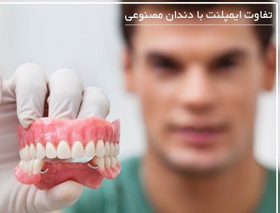 پروتز با ایمپلنت دندان چه تفاوتی دارد