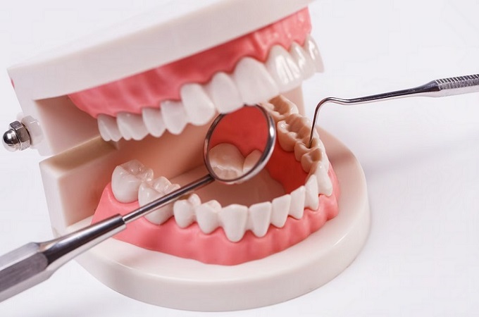 روش های زیبایی دندان کدامند