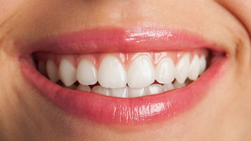 مینای دندان چیست و چگونه درمان میشود