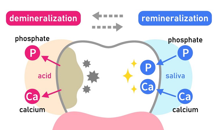 مواد معدنی و ویتامین ها بر روی دندان های شما چه تاثیری دارد