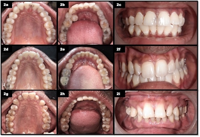 بیماران تالاسمی کدام از خدمات دندانپزشکی را میتوانند انجام بدهند
