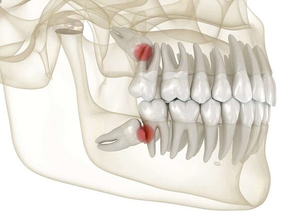 ساختار دندان مولر چگونه است