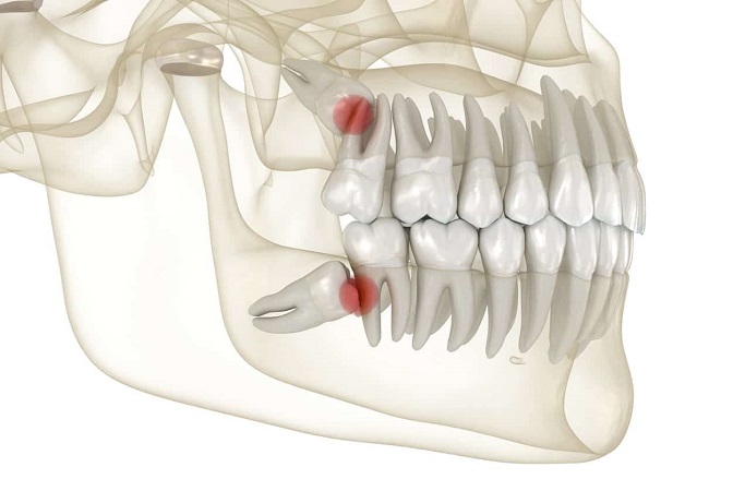 ساختار دندان مولر چگونه است