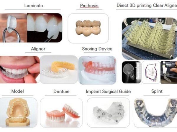 فرآیند انجام پرینت سه بعدی در دندانپزشکی به چه روشی است