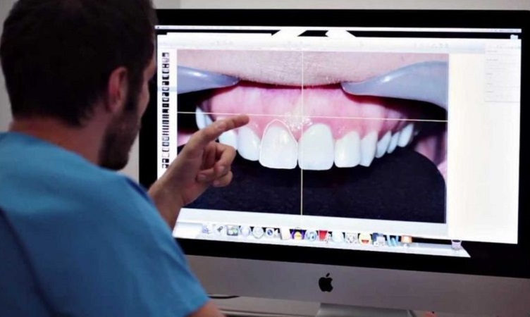 قالب گیری دیجیتال دندان چه مزایایی دارد